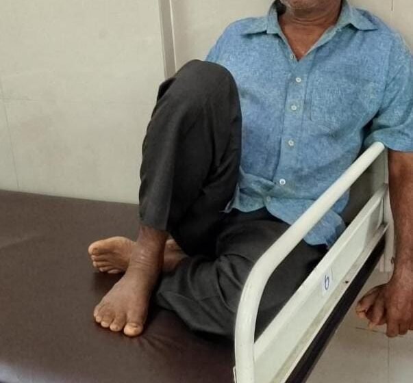 घरात झोपलेल्या वृद्धवर माकडाने केला हल्ला, वृद्धवर उपचार सुरू