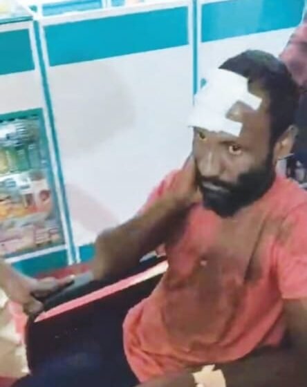  गुहागरमध्ये तरुणाला एसटी बसने उडवले, गंभीर जखमी